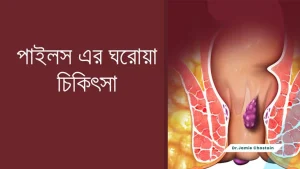 পাইলস এর ঘরোয়া চিকিৎসা